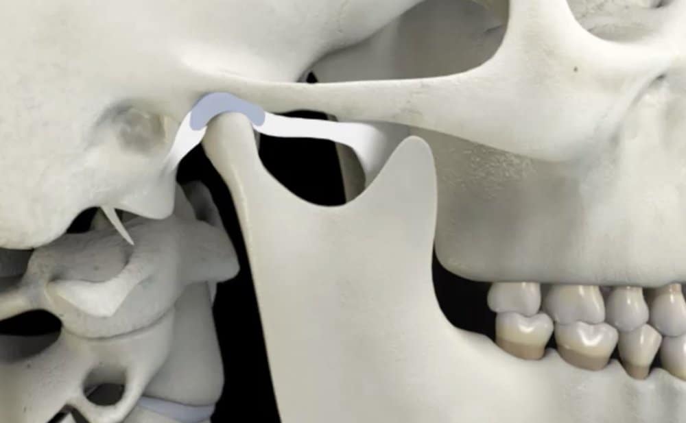  5 Habits Making Your TMJ Pain Worse