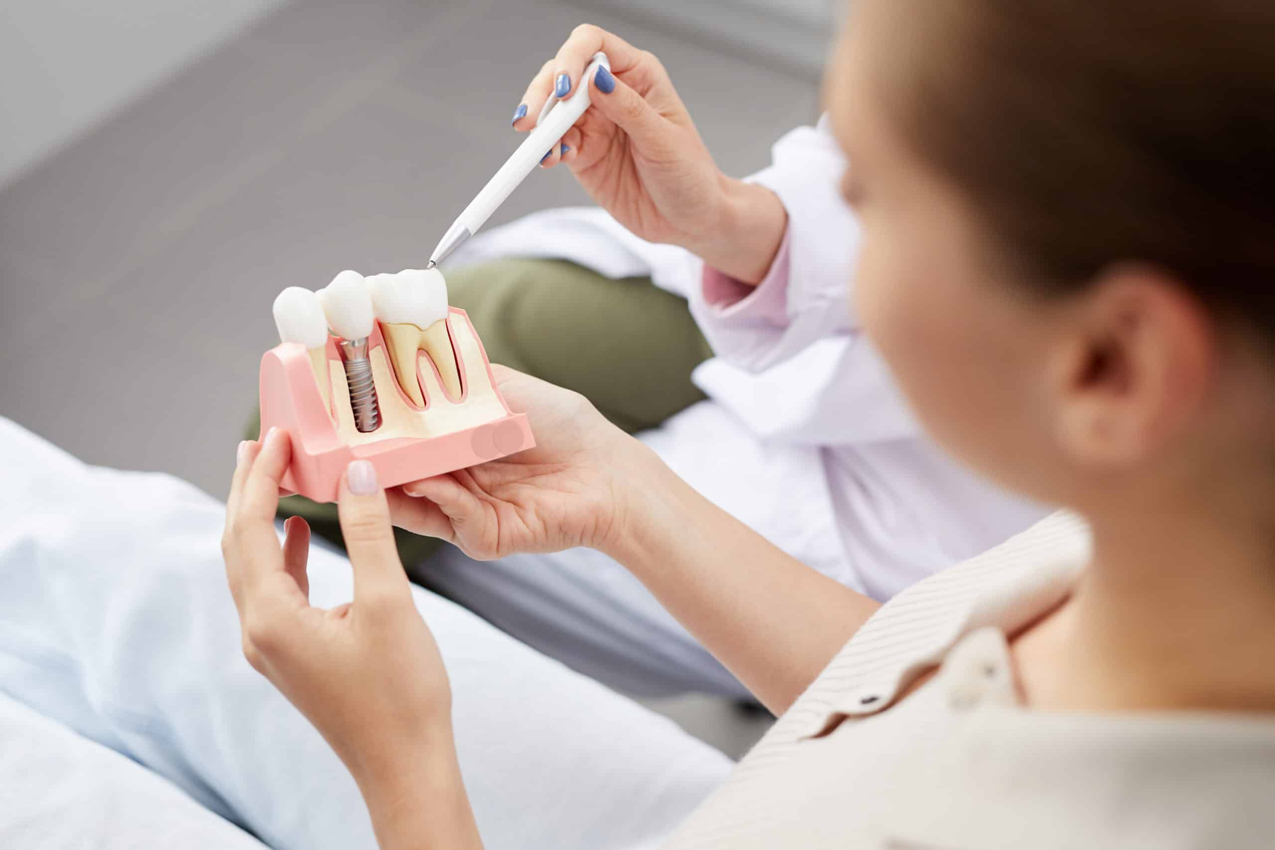  4 Risk Factors Contributing to Dental Implant Failure