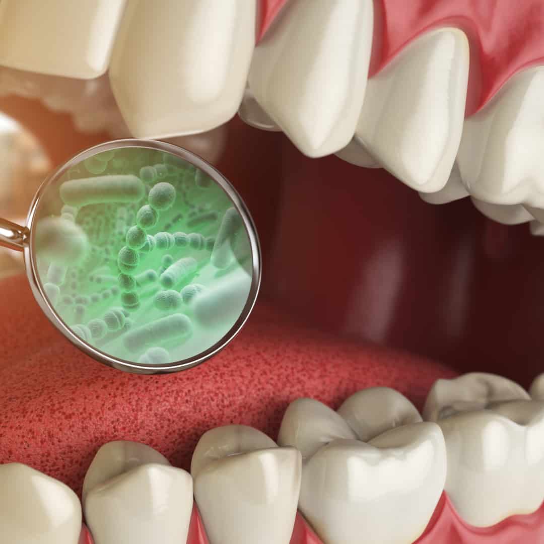  Optimizing Eating Habits: The Impact of Food Choices on Gum Health & Preventing Tooth Decay