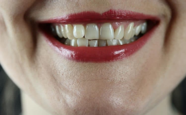  5 Foods to Strengthen Your Dental Gum Health And Enhance Your Smile