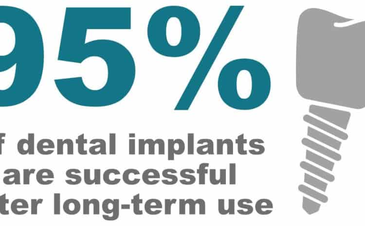  How Dental Implants Success Rate is influenced by Autoimmune Diseases?