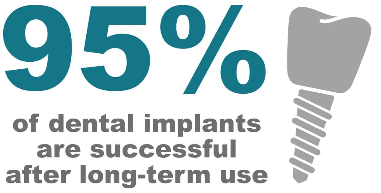  How Dental Implants Success Rate is influenced by Autoimmune Diseases?