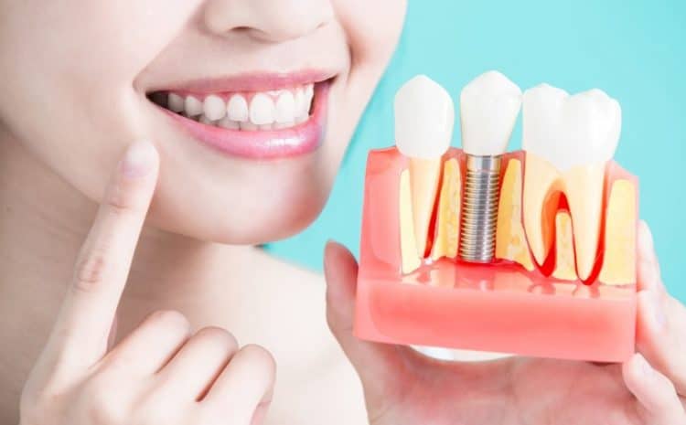  Painless and Top-Notch Same-Day Dental Implants in Mississippi