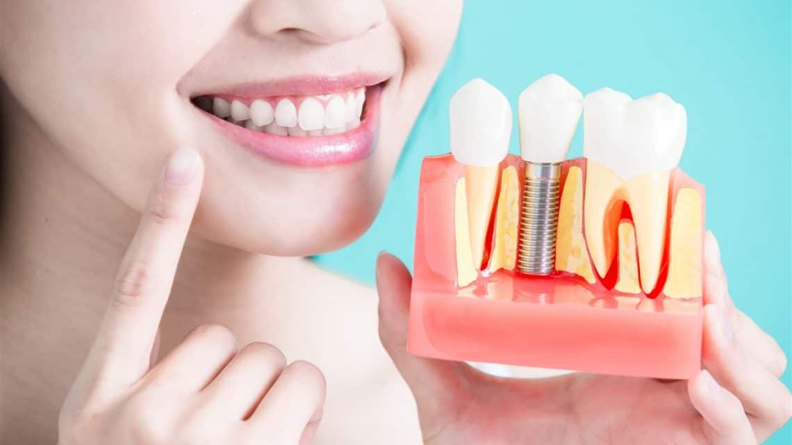  Painless and Top-Notch Same-Day Dental Implants in Mississippi