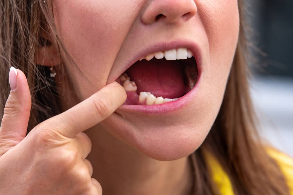  Psychosocial Consequences of Tooth Loss You Didn’t Know
