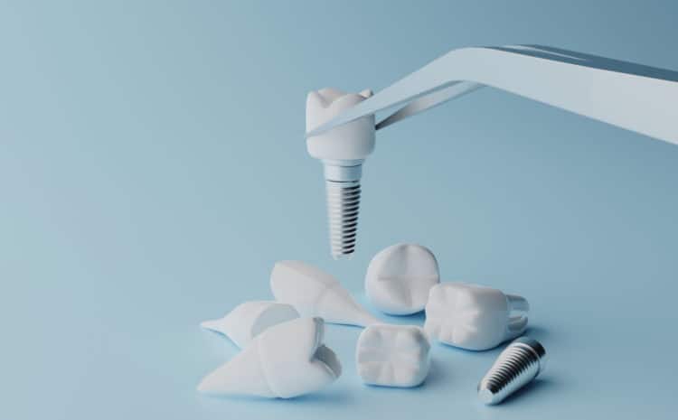  Zirconia Dental Implants or Titanium Dental Implants? Which are best for me?