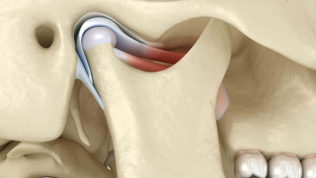 different types of tmj disorders treated by Dr. Adatrow