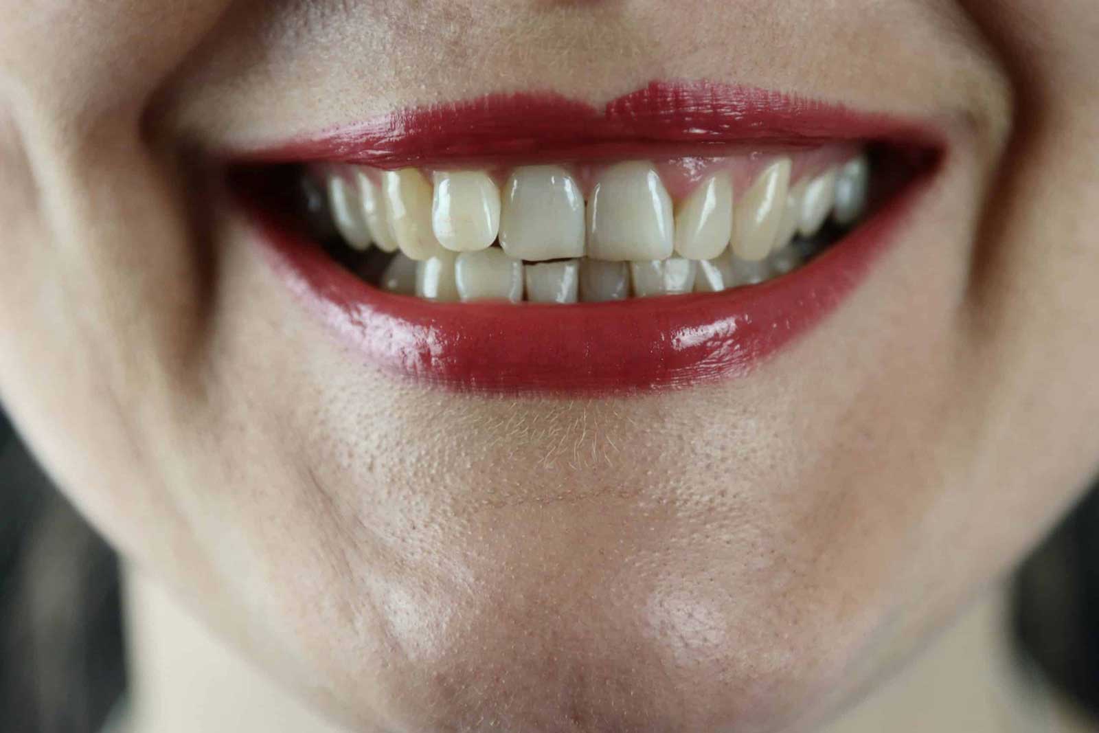  Healthy Gums, Happy Life: Top Food Habits for Gum Health