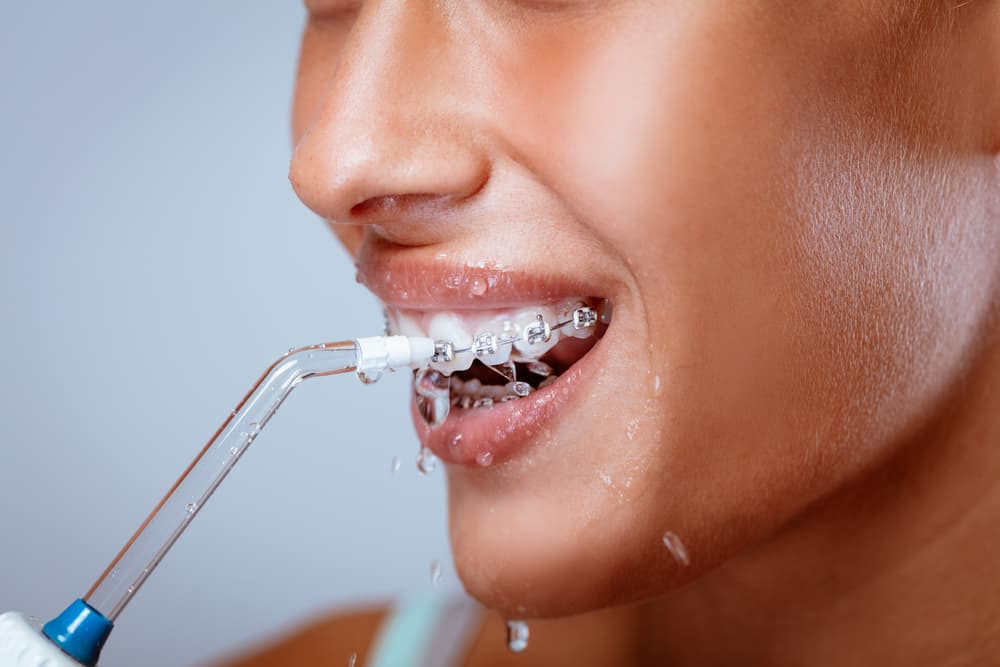  Water Flosser vs. Traditional Floss: Pros, Cons & Usage Tips