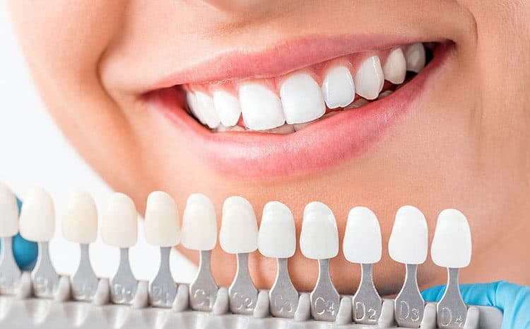  Zirconia Dental Implants: Everything you need to know