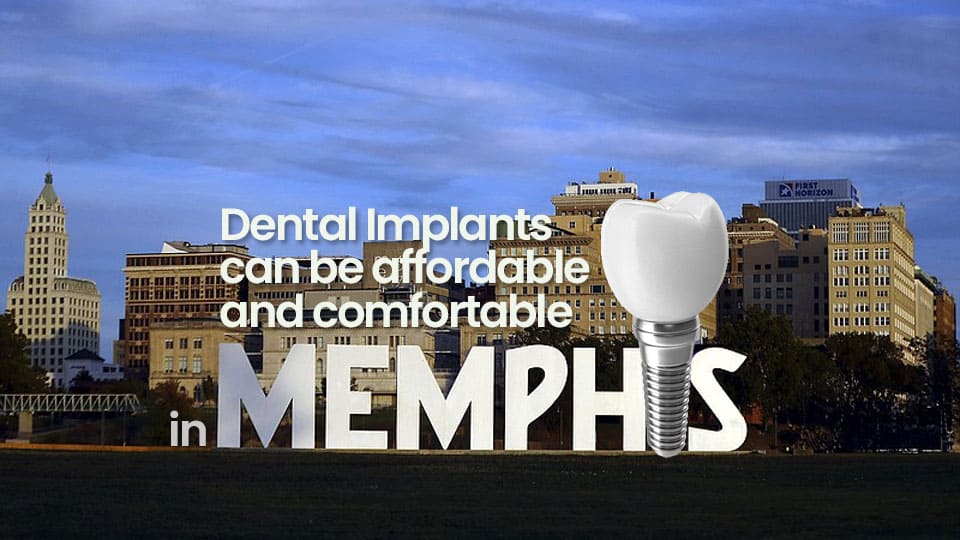  Dental Implants can be affordable and comfortable in Memphis