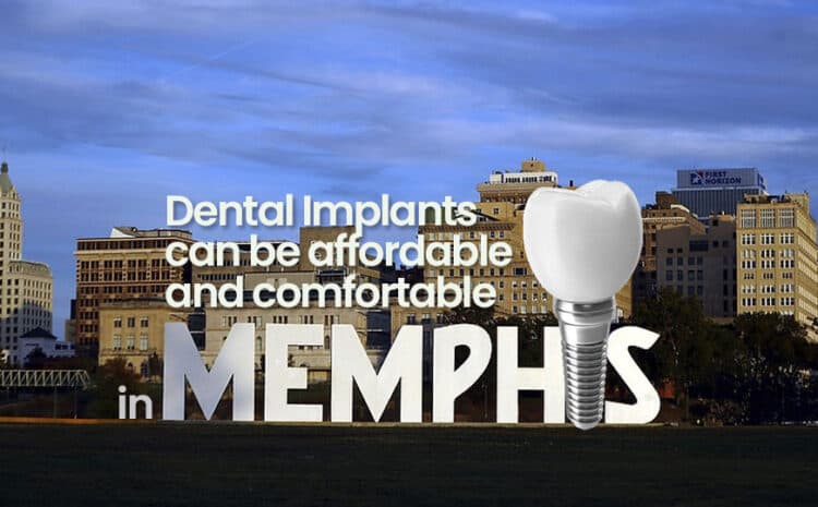  Dental Implants can be affordable and comfortable in Memphis