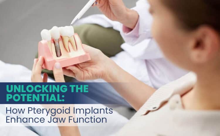  Unlocking the Potential: How Pterygoid Implants Enhance Jaw Function