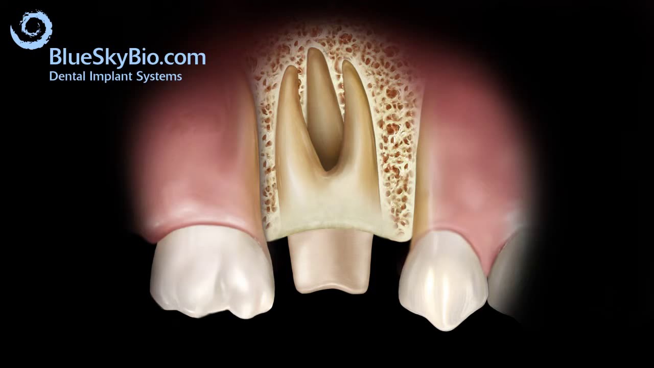  The Basics of Temporomandibular Disorder