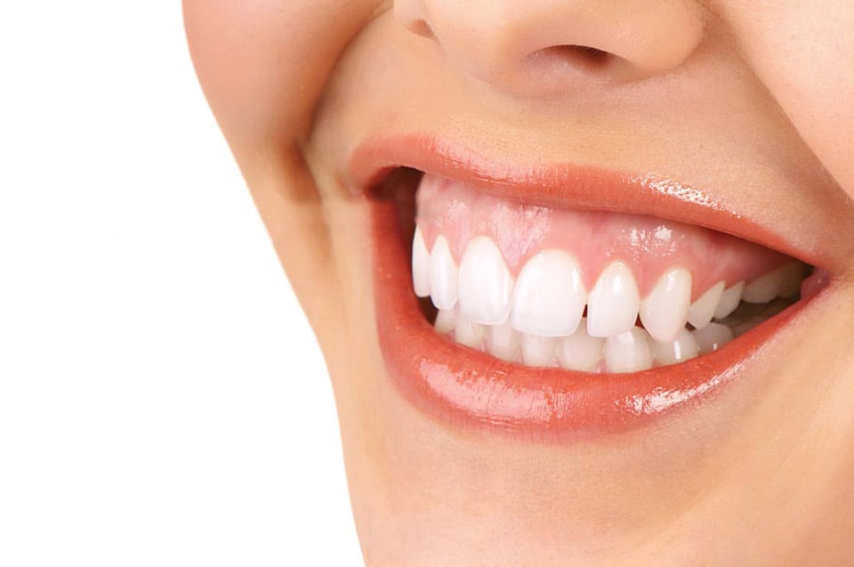 Transform Your Smile with Dark Gum Treatment at Advanced Dental Implant and TMJ Center