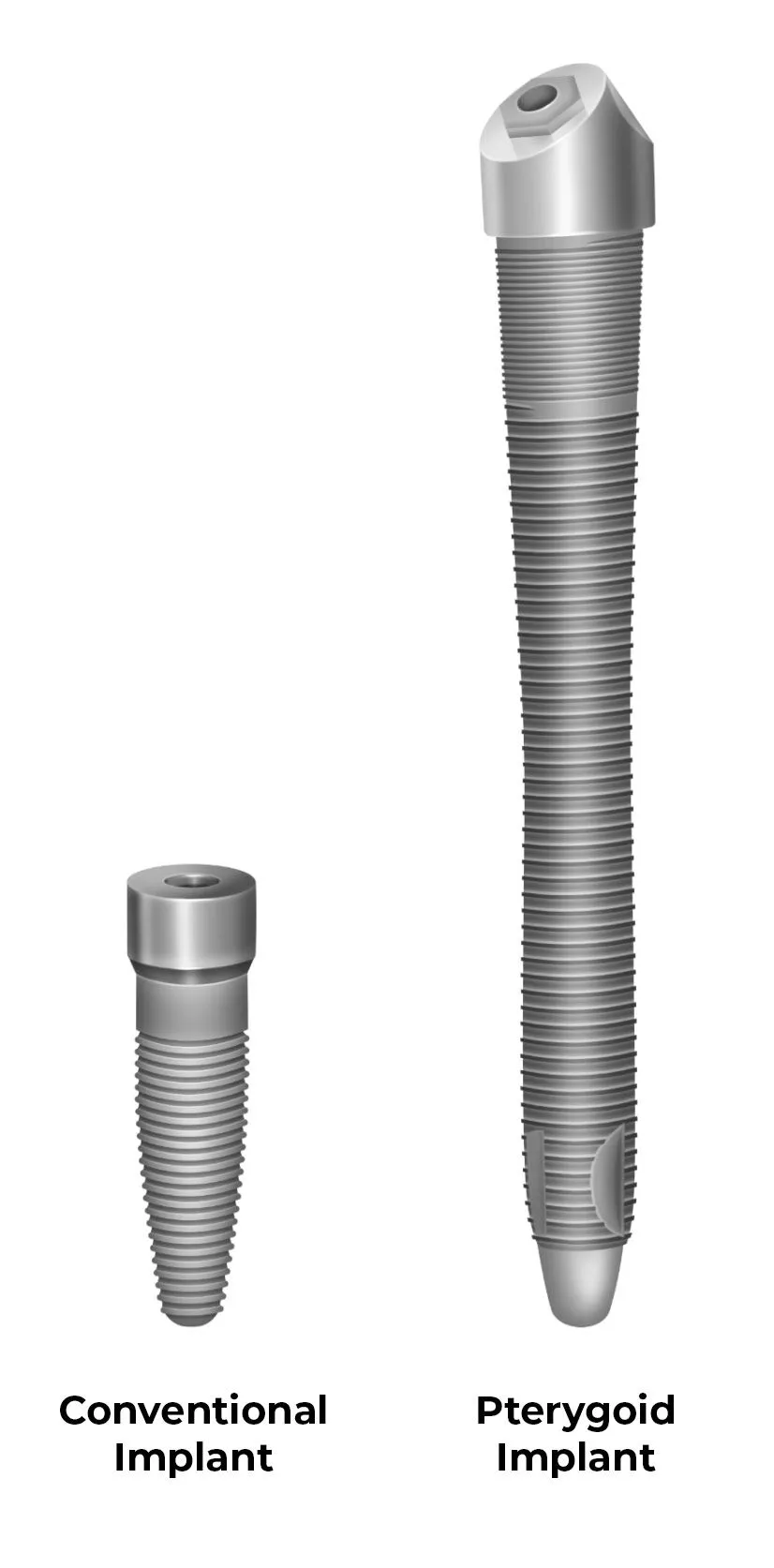 Pterygoid Dental Implant